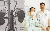Không triệu chứng, người phụ nữ bất ngờ phát hiện u thận lan vào tĩnh mạch chủ
