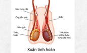 Nam sinh 14 tuổi phải cắt bỏ tinh hoàn do nhập viện muộn