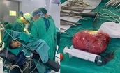 Phẫu thuật thành công khối u sau phúc mạc khổng lồ nằm ở vị trí phức tạp