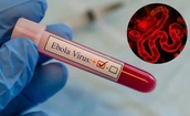 TPHCM tăng cường giám sát trước nguy cơ dịch Ebola xâm nhập