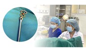 Bỏ quên vòng tránh thai suốt 30 năm, người phụ nữ 63 tuổi gặp biến chứng phụ khoa
