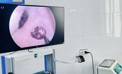 Đau nhức tai suốt một tuần, người phụ nữ tá hỏa vì 'vị khách lạ' trong tai