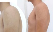 Cổ rụt, lưng gù vì ngồi học vẹo vọ, bò ra bàn