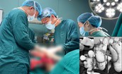 Suýt mất 2 bàn chân vì tự chườm nóng tại nhà khi bị tê bì