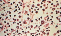 Đài Loan (Trung Quốc) ghi nhận 1 ca tử vong do nhiễm virus Hanta