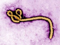 Ebola có lây qua đường tình dục?