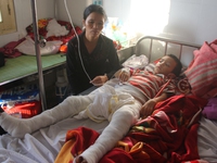 Bé trai bỏng nặng sau hình phạt của người cha