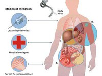 Hướng dẫn chẩn đoán và điều trị bệnh do vi rút Ebola