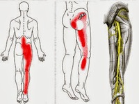 Cải thiện chứng đau mỏi cơ thể