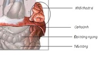 Thoát vị hoành bẩm sinh - Tỉ lệ sống thấp, vì sao?