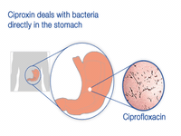 Ciprofloxacin - “Chàng dũng sĩ” lắm tài, nhiều tật