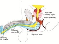 Hẹp niệu đạo