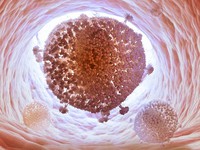 Lần đầu tiên “xóa sổ” virus HIV trong DNA của người