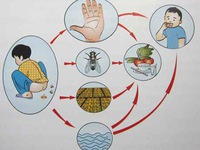 Tiếp tục giải đáp về dịch bệnh mùa hè