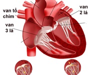 Hở van ba lá có nguy hiểm?