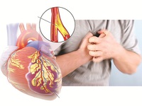 Những nguy cơ trên tim mạch khi bổ sung testosteron!