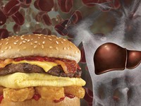 Cholesterol giúp bạn khỏe mạnh