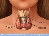 Các phương pháp điều trị bướu cổ bằng phẫu thuật