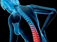 Những nguyên nhân thường gặp gây đau lưng
