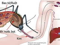 Tuyệt đối không dùng những thuốc sau khi sốt xuất huyết