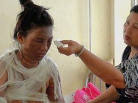Bạo hành gia đình, nơi pháp luật “bất khả thi”?