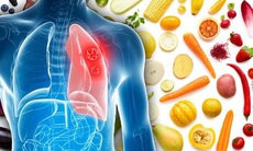 8 thực phẩm người bệnh ung thư phổi nên ăn thường xuyên