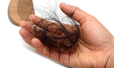 Đông y khắc phục chứng rụng tóc như thế nào?