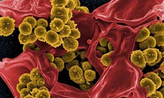 Vì sao bệnh nhân sau cấy ghép gan dễ nhiễm vi khuẩn kháng thuốc?