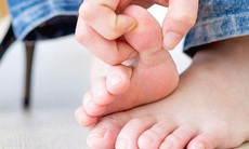 Thường xuyên ăn các món từ nước hầm xương, bé gái 7 tuổi mắc 'bệnh của người già'