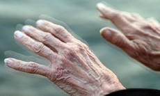 Thuốc nhỏ mũi có triển vọng làm chậm bệnh Parkinson