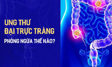 Ung thư đại trực tràng - Nguyên nhân, cách phát hiện và tầm soát