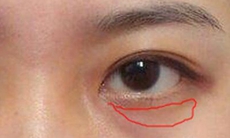 4 dấu hiệu trên khuôn mặt cho thấy nữ giới đang mắc bệnh phụ khoa