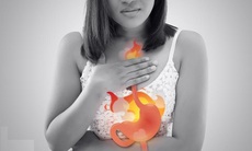Người mắc chứng ợ nóng nên ăn gì và kiêng gì?
