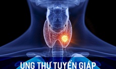 Ung thư tuyến giáp: Phương pháp điều trị, tiên lượng sống và theo dõi nguy cơ