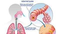 Món ăn, bài thuốc trị viêm phế quản tái phát trong mùa đông