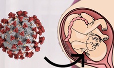 Nguy cơ sinh non ở những phụ nữ mang thai bị nhiễm COVID-19 nặng