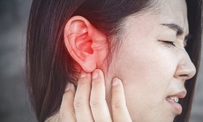 Viêm sụn vành tai do sở thích xâu nhiều khuyên tai ở giới trẻ