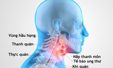 Thở khò khè, ho cảnh giác với ung thư khí quản