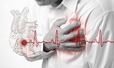 Suy tim: Nhận biết, nguyên nhân, điều trị và đề phòng biến chứng 