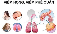 Đột phá mới hỗ trợ giảm ho do viêm họng, viêm phế quản, ho kéo dài