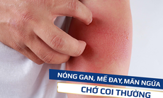 7 dấu hiệu cảnh báo gan tổn thương, nhiễm độc tố