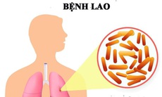 Bài thuốc hỗ trợ trị lao phổi