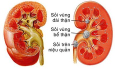 Trị viêm tiết niệu từ cây rau đắng