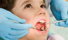 Chăm sóc răng miệng cho trẻ em trong thời gian giãn cách