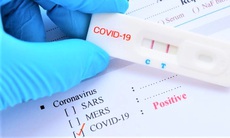 Chỉ mua sản phẩm kit test COVID-19 nằm trong danh mục Bộ Y tế cấp phép lưu hành