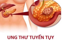 Hiệu quả từ phối hợp thuốc mới trong điều trị ung thư tuyến tụy