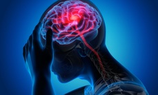 Nhận biết và đề phòng đau đầu migraine tái phát