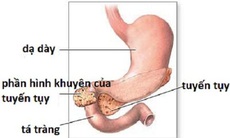 Tắc tá tràng ở trẻ sơ sinh - Mẹ cần biết để phát hiện sớm