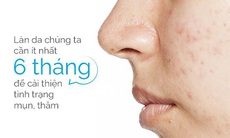 Da “bùng nổ” mụn vì thói quen sinh hoạt mùa dịch