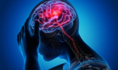 Giải pháp dành cho người cao tuổi suy giảm trí nhớ